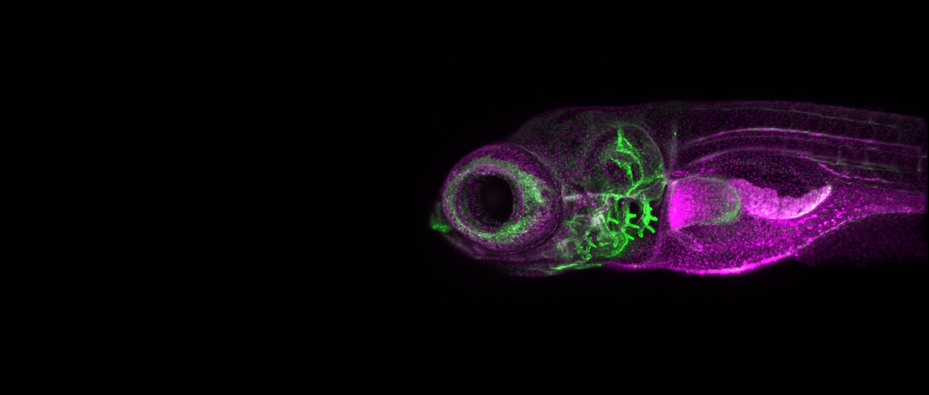 Zebrafish with fibronectin matrix labeled